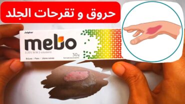 أفضل مرهم لعلاج الحروق و التقرحات الجلدية  ميبو MEBO