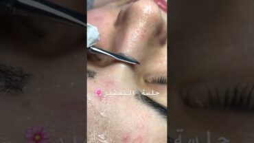 تقشير البشرة بأحدث الطرق 2020❤️skin care 2020