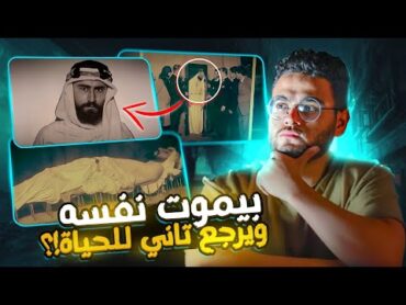 دكتور مصري فعل المستحيل فأتهموه بالسحر والشعوذ ة   حبيب