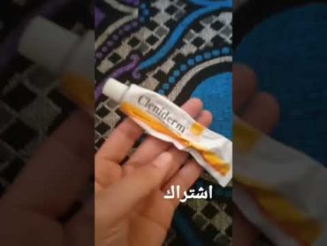 أخطر بومادا فالعالم لجميع أنواع أمراض الجلد ضروري تكون فكل بيت حساسيةالجلد