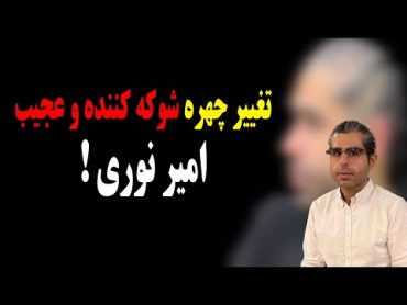 تغییر چهره شوکه کننده و عجیب امیر نوری!