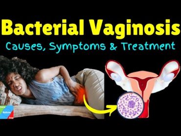 Bacterial Vaginosis (BV) – Symptoms, Causes, Diagnosis & Treatment