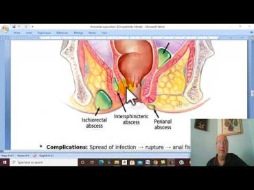 Anal Disorders in Arabic 6  (Anorectal Suppuration) , by Dr. Wahdan