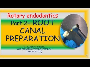 Root canal preparation with rotary flies Rotary endodontics part 2 Rotary endo for beginners