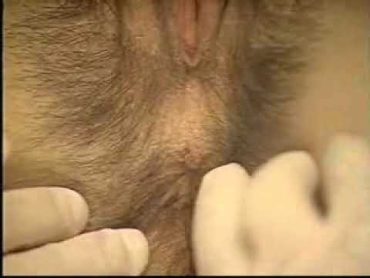 06 Rectovaginal Examination  Examination of the Rectum