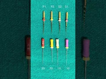 Root canal preparation with rotary files http://www.youtube.com/@sumeetasandhu