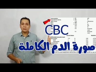 CBC ازاى تقرا تحليل صورة الدم الكاملة