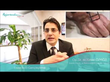 تجميل اليدين بالليزر وإزالة التجاعيد laser Hand Rejuvenation