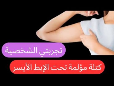 تجربتي مع كتلة (ورم) تحت الإبط الأيسر وإزاي عالجتها