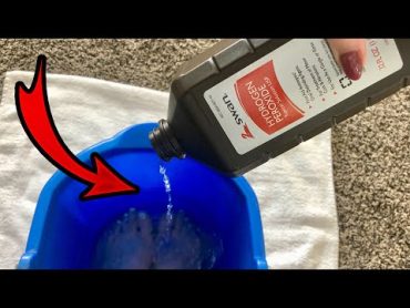 Put Hydrogen Peroxide on your FEET & SEE WHAT HAPPENS! 💥 (this is cool and surprising)