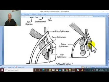 Anal Disorders in Arabic 7  (Anal Fistula , parts 1) , by Dr. Wahdan