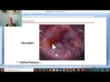 Anal Disorders in Arabic  2  (Piles, part 2 ) , by Dr. Wahdan