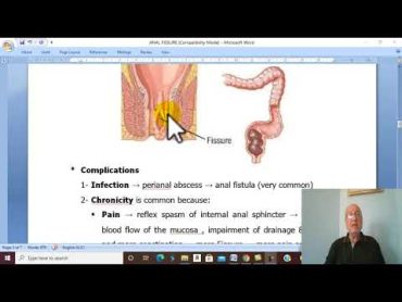 Anal Disorders in Arabic 4  (Anal Fissure , part 1 ) , by Dr. Wahdan