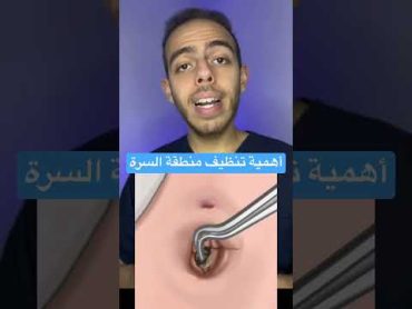 أهمية تنظيف منطقة السرة وخطر الحصوات بها medicine short طب