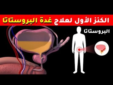 الكنز الأول في علاج التهاب وتضخم غدة البروستاتا والمسالك البولية وضعف الانتصاب