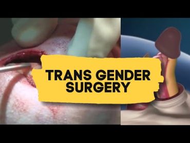 Trans gender surgery  Male to Female  Education