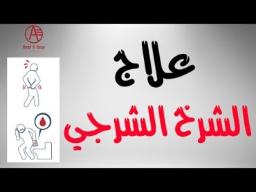 علاج الشرخ الشرجي  ألم المؤخرة  Anal Fissure