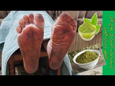 استخدامات الحناء في علاج الآم الظهر وحرارة القدمUses of henna in the treatment of back And the foot.