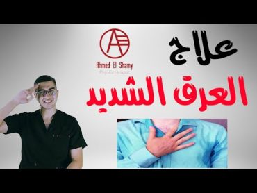 العرق الشديد  علاج العرق الشديد  Hyperhidrosis