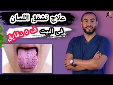 وصفات سحريه لعلاج تشقق اللسان اقسم بالله مش هتحتاج دكتور 🥳👌 علاج تشقق اللسان عند الكبار فى المنزل 🦷