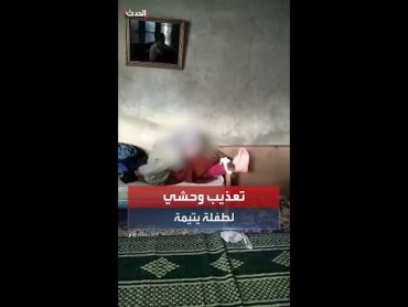 تعذيب وحشي لطفلة يتمية على يد زوج والدتها في سوريا