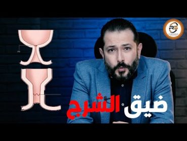 ايه هو ضيق الشرج و أهم أسبابة و طرق علاجة مع د رامي صلاح الدين