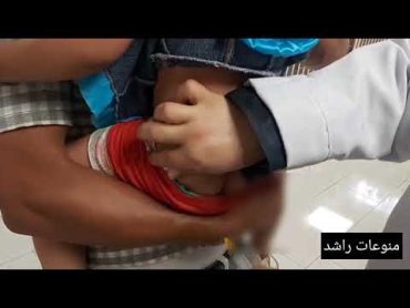 حقنتين عضل لنفس البنونة بأقل من دقيقة Intramuscular injection for a child easily @em jood