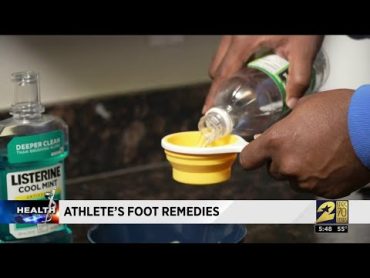 How to help knock out Athlete&39;s Foot