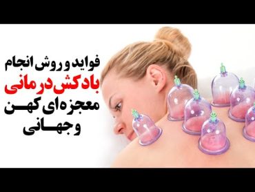 بادکش درمانی معجزه ای جهانی / فواید و آموزش روش انجام آن