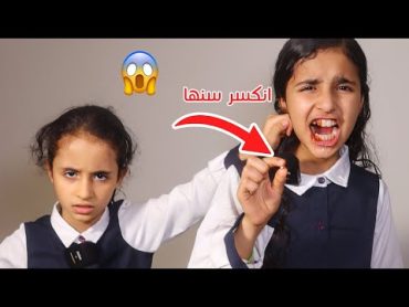 لما بنتك ينكسر سنها بسبب نهاية التنمر في المدرسةمؤثر  !! سوالف بناتي