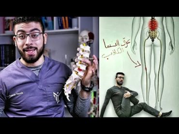 علاج ألم وتنميل المؤخرة والرجل بتمرين واحد فقط  عرق النسا الكاذب