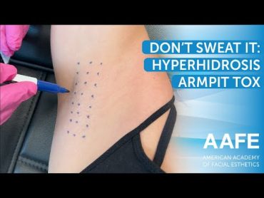 Don&39;t Sweat It: Hyperhidrosis Armpit Tox