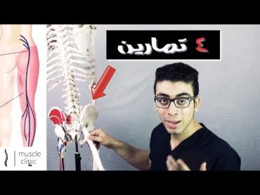 اسباب عرق النسا  وافضل 4 تمارين لعلاج عرق النسا sciatica treatment