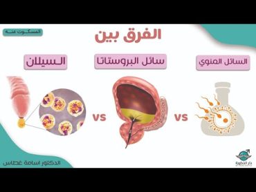 الفرق بين السيلان و سائل البروستاتا و السائل المنوي !المسكوت عنة  الدكتور أسامة غطاس