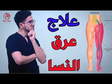 علاج عرق النسا  أفضل تمارين لعلاج ألم النسا  Sciatica