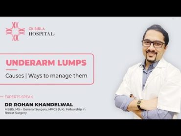 Underarm / Armpit lumps  Causes & Treatment  Dr. Rohan Khandelwal  Breast Cancer Surgeon