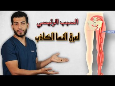 اسباب عرق النسا الفرق بين عرق النسا الحقيقى وعرق النسا الكاذب وعلاجهما  د.احمد هيكل