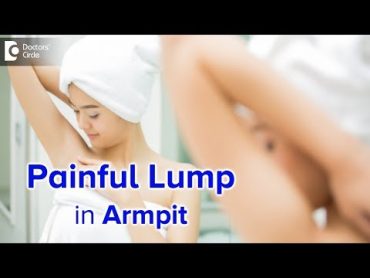 Painful armpit lump  Causes, Diagnosis and Treatment  Dr. Nanda Rajaneesh  Doctors&39; Circle