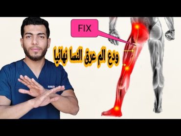 ودع عرق النسا نهائيا بعد هذا الفيديواسباب وأعراض وأحدث الطرق لعلاج عرق النسا (التهاب العصب الوركى)