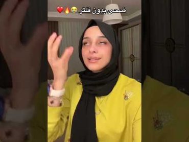 ضحى بدون فلتر😱😱