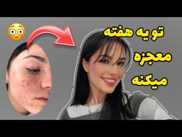 * clear skin *بدون هزینه پوستتو مثل پوست بچه کن