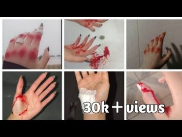 🫣😂🤕 Accident dp ideas 2023  hand bandage dp for girls  hand cut dpz  cannula hand dp photo