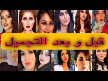 مشاهير ويوتيوبرز عراقيات قبل وبعد التجميل  Iraqi celebrities before and after aesthetics