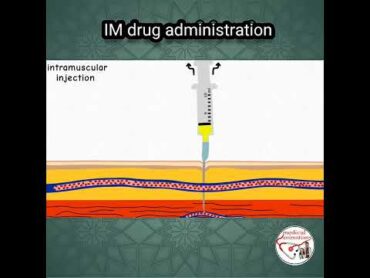 💉 INTRAMUSCULAR (IM) INJECTION, PROCEDURE  ANIMATED EXPLANATION