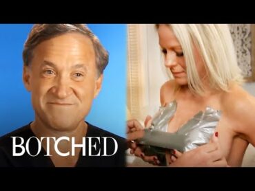 12 Most INSANE Breast Jobs of "Botched"mas  Botched  E!