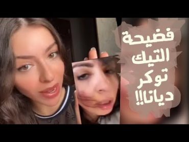 مقطع فيديو فضيحة التيك توكر ديانا!!