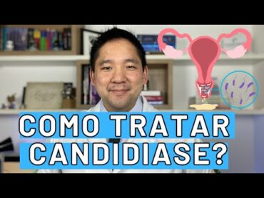 COMO TRATAR CANDIDIASE VAGINAL, A PRINCIPAL CAUSA DE COCEIRA NA MULHER