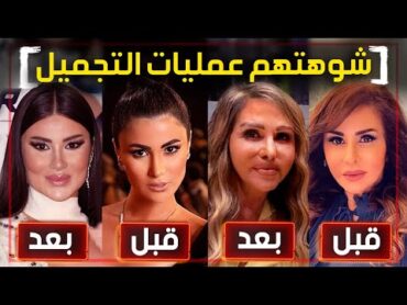 اشهر 7 فنانين دمرتهم  عمليات التجميل الفاشله !!