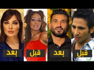 8 فنانين تحولو قبل وبعد عمليات التجميل