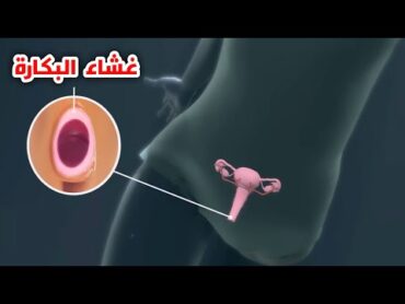 ماهو غشاء البكارة؟! وماهي انواعة (كل ماتحتاج معرفتة عن غشاء البكارة)  ?What is the hymen